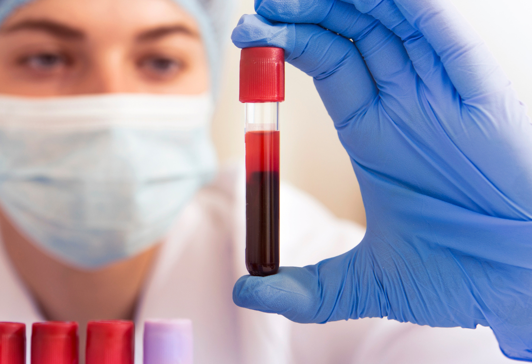 Novo teste ao sangue pode prever risco de doença cardíaca, em sobreviventes de cancro pediátrico