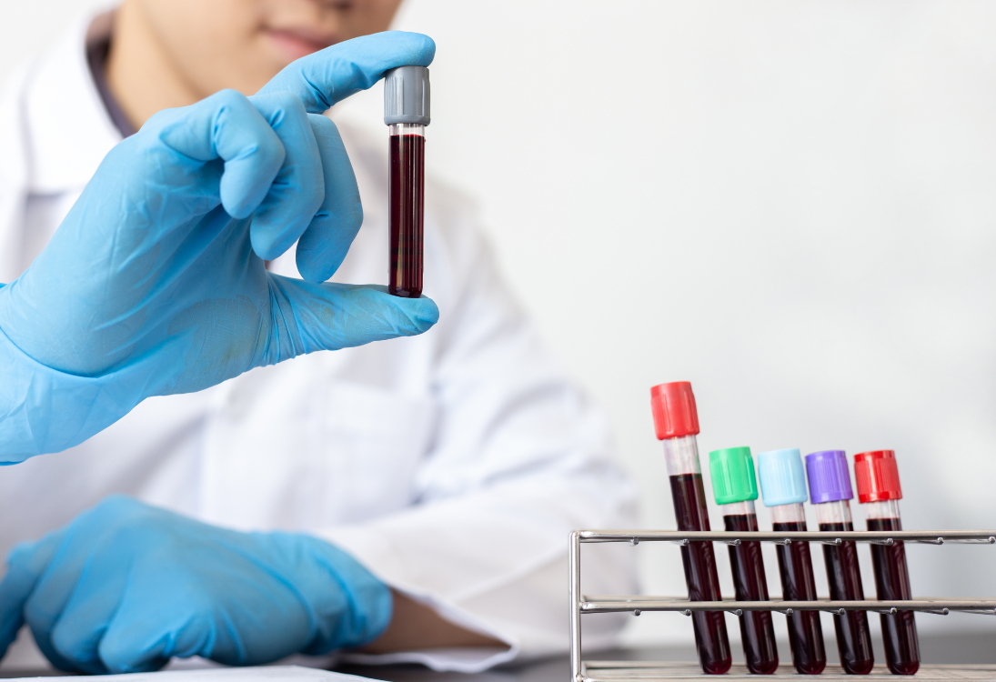 Nova abordagem para combater neuroblastomas através da inibição de selenoproteínas