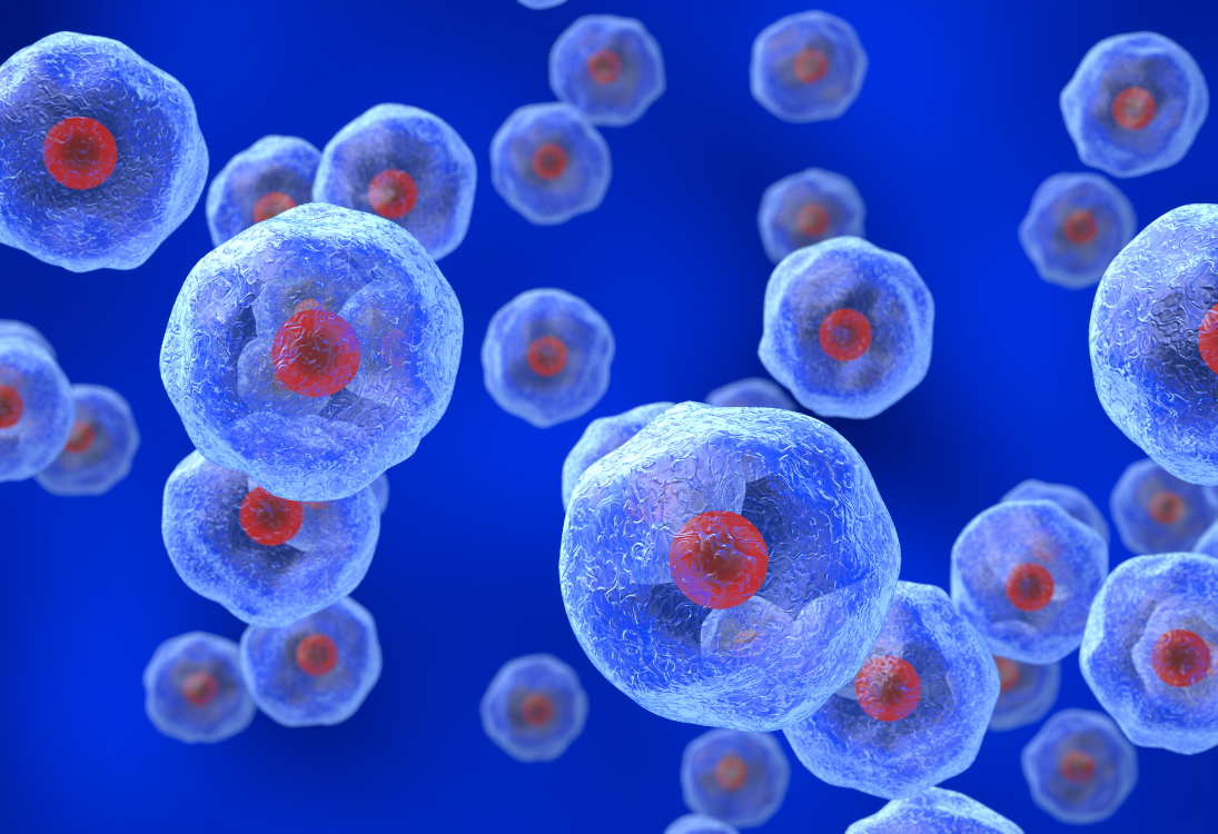 Nova abordagem pode melhorar tratamento de meduloblastoma agressivo em crianças
