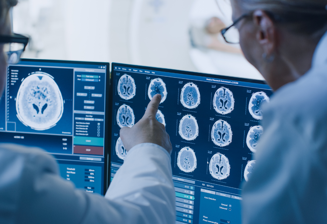 Cientistas descobrem forma de travar tumor cerebral pediátrico antes de se formar