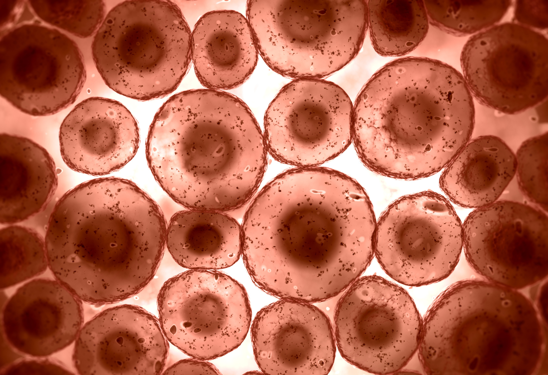 Medicamento mostra potencial no tratamento de gliomas pediátricos agressivos