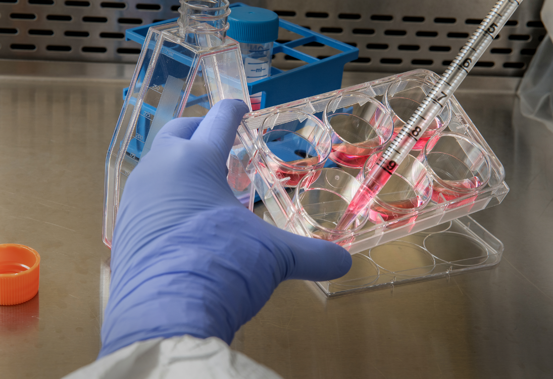 Novo “atlas celular” revela como os tumores de neuroblastoma mudam durante o tratamento