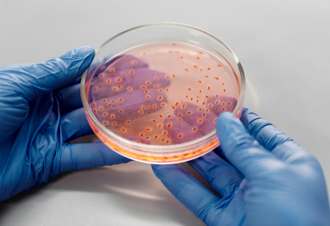 Nova toxina bacteriana pode estar a aumentar o risco de cancro colorretal desde a infância