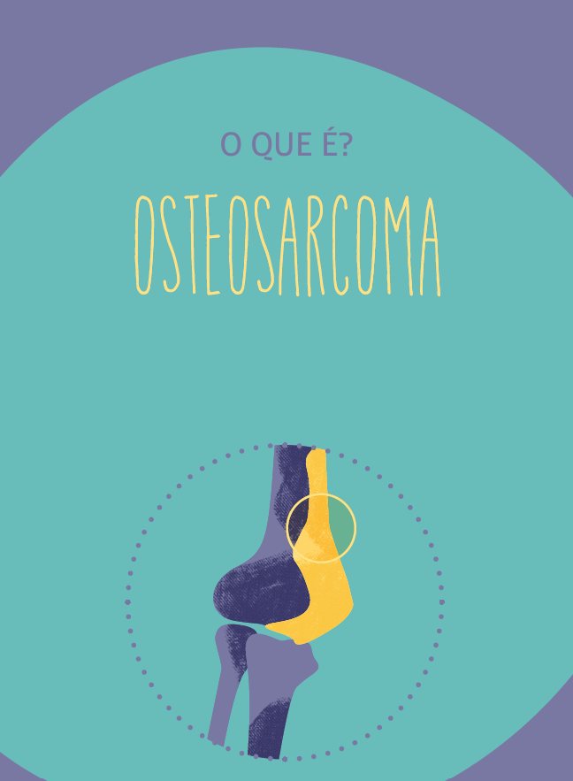 Osteosarcoma
