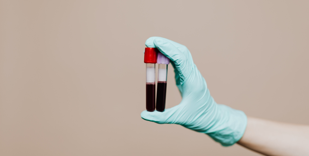 Novo teste ao sangue pode ajudar a tratar melhor o cancro pediátrico