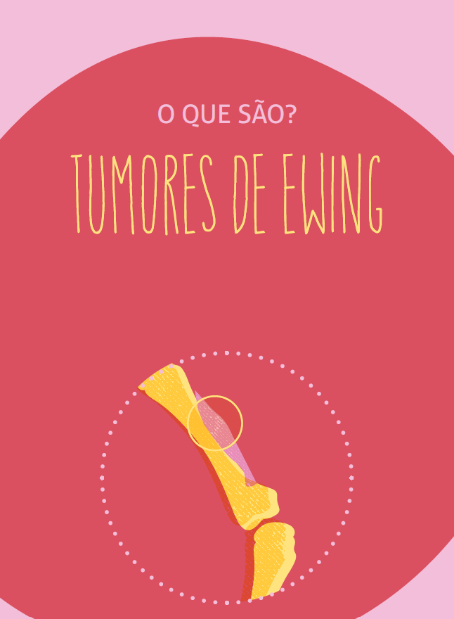 Tumores de Ewing