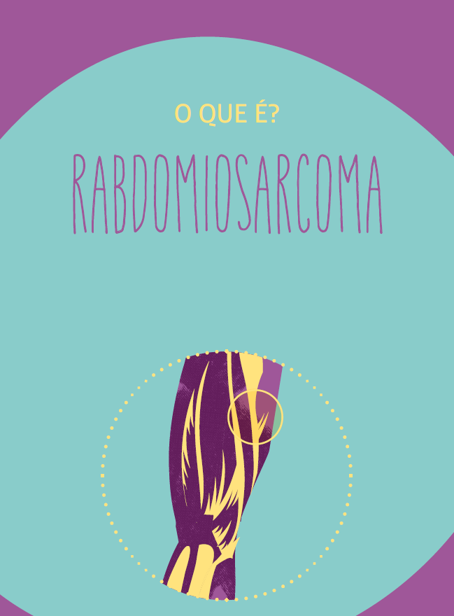 Rabdomiosarcoma