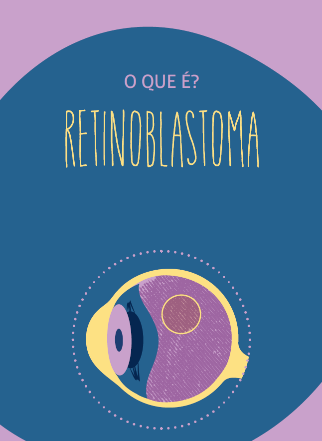 Retinoblastoma