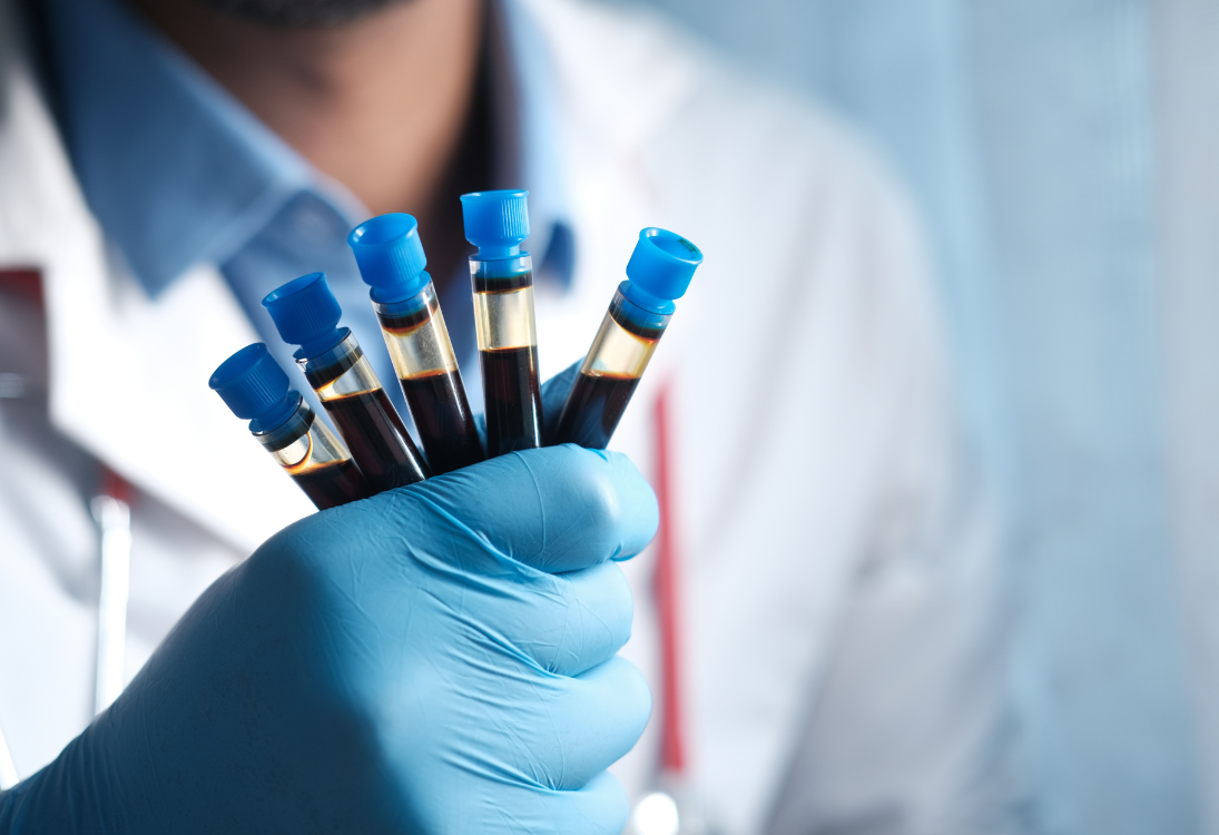 Novo teste ao sangue pode substituir biópsias na monitorização do mieloma múltiplo