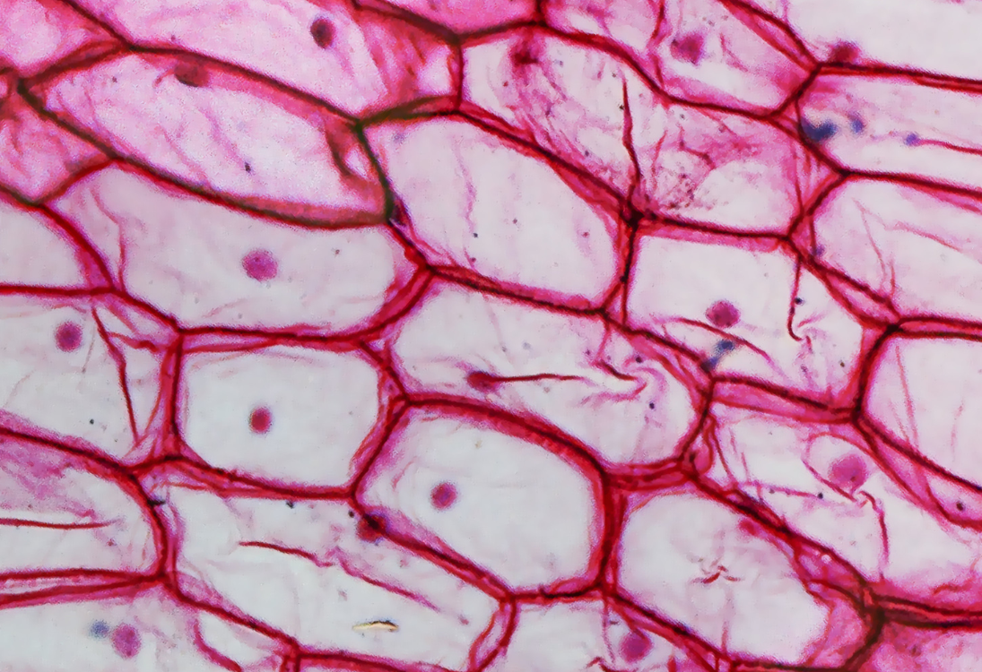 Nova terapia com células imunitárias editadas pode tornar tratamento contra o cancro mais rápido e acessível