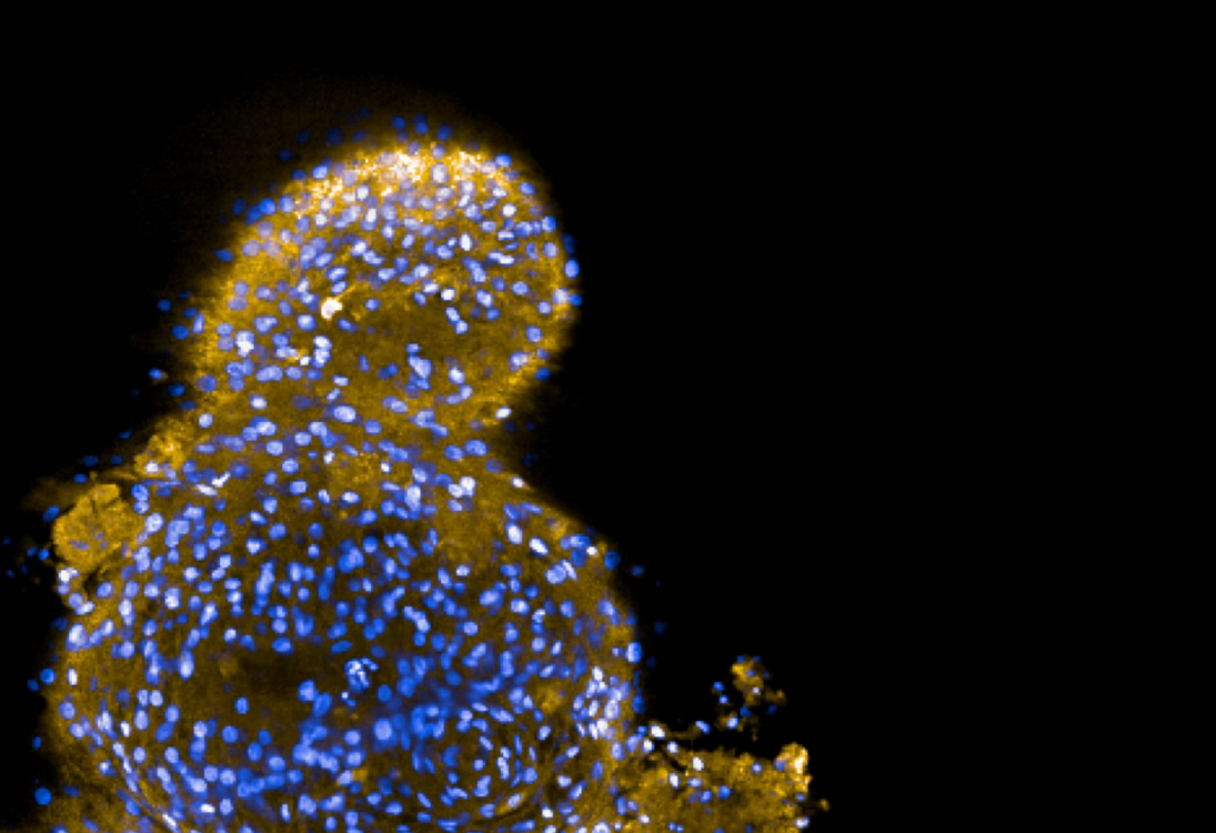 i3S cria “mini-tumores” cerebrais para personalizar tratamento do cancro pediátrico